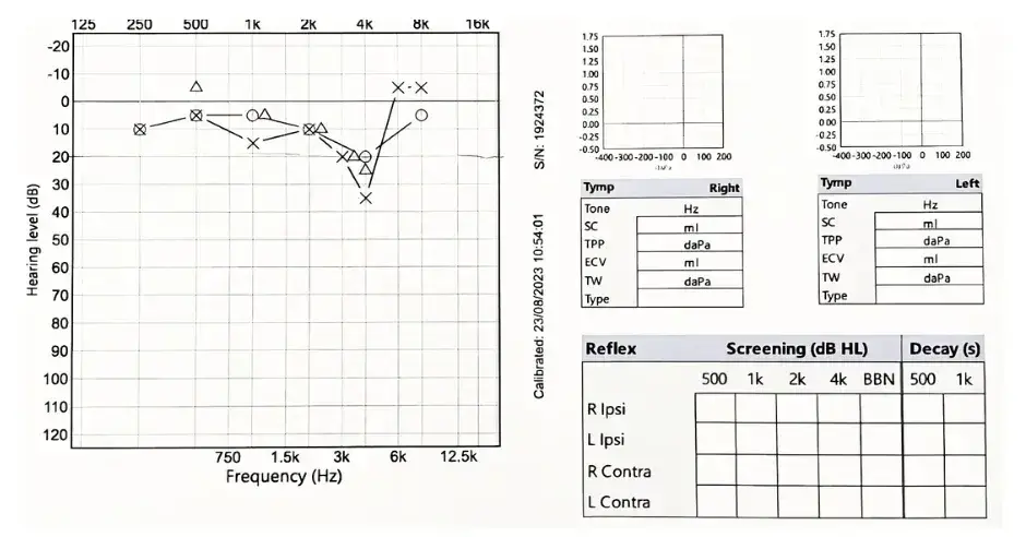 audiology report